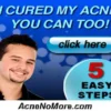Acne No More
